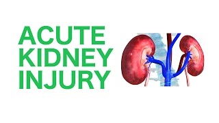 Acute Kidney Injury AKI  USMLE [upl. by Euqinommod]