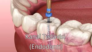 Kanal Tedavisi  Endodonti [upl. by Allin]