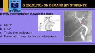 Ttube cholangiography  Post operative cholangiography  Biliary imaging system part 3 [upl. by Enylecoj]