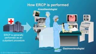 What is a Cholecystectomy [upl. by Rather]