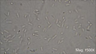 Bacteria under the Microscope E coli and S aureus [upl. by Eichman]