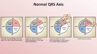 Intro to EKG Interpretation  Rate and Axis [upl. by Chastity]