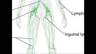 What is Lymphedema  UC Davis Comprehensive Cancer Center [upl. by Absalom196]