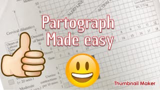 partograph made easy [upl. by Macpherson]