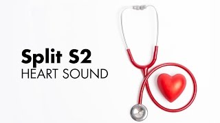 Fixed Split S2  Heart Sounds  MEDZCOOL [upl. by Rieth821]