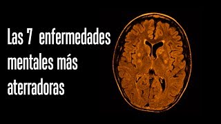 Las 7 enfermedades mentales más aterradoras [upl. by Shirk]