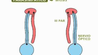 Reflejos pupilares  Oftalmología [upl. by Dnomyad]
