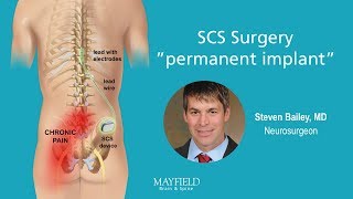 HF10 Spinal Cord Stimulation Part 2 Surgery [upl. by Esinned]