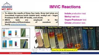 Understanding of Biochemical test IMViC [upl. by Notsniw]