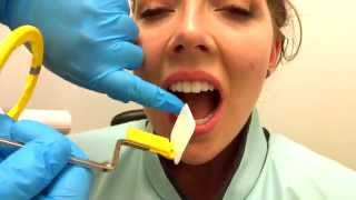 How to Take Periapical Radiographs [upl. by Netnert]