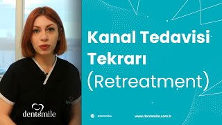 Kanal tedavisi tekrarı retreatment [upl. by Rebak454]