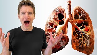 What Vaping Does to the Body [upl. by Alleciram]