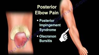 ELBOW PAIN  COMMON CAUSES  Everything You Need To Know  Dr Nabil Ebraheim [upl. by Adora]