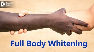 Full body whitening procedure How is it done What is the Cost Dr Rajdeep MysoreDoctors Circle [upl. by Ventura]