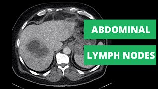 How to explore lymph nodes on ENT [upl. by Cornwall]