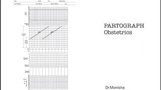 How to read a PARTOGRAPH  Obstetrics [upl. by Hardunn]