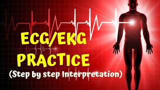 HOW TO READ AN ECG in 10 mins part2   ECG  EKG PRACTICE [upl. by Mihcaoj]