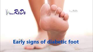 Early Signs of Diabetic Foot [upl. by Roberta138]