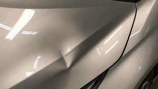 PDR Aluminum Hood Dent [upl. by Compte528]