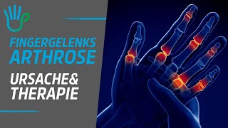 Fingergelenksarthrose  Ursache Therapie amp Übungen [upl. by Esojnauj]