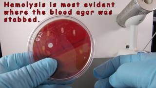 Beta Hemolysis on Blood Agar [upl. by Pry]