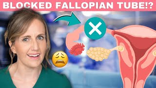 What can cause blocked fallopian tubes [upl. by Akitahs859]