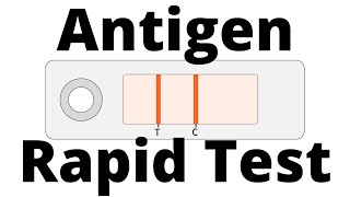 How SARSCoV2 Antigen Rapid Tests work Covid19 Testing [upl. by Lechar]