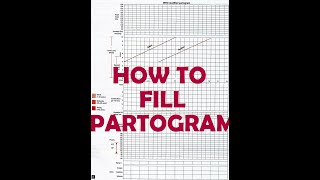 HOW TO FILL PARTOGRAM  VERY EASY [upl. by Nylrahs]