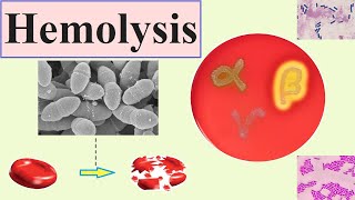 hemolysis [upl. by Prader]