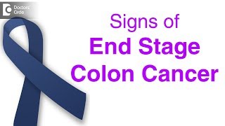 What are the Symptoms of Colon Cancer [upl. by Eiblehs]