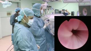 RCOG GUIDELINE Best Practice in Outpatient Hysteroscopy Part 2 [upl. by Eetnwahs]