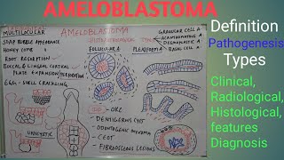 Ameloblastoma  Definition pathogenesis types clinical radiological features and diagnosis [upl. by Neenaj]