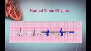 Intro EKG Interpretation Part 1 [upl. by Epifano382]