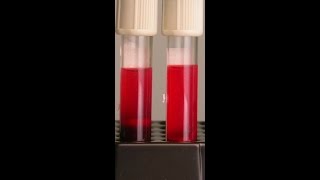 Preventing Hemolysis in the Blood Samples You Draw [upl. by Atsirhcal896]