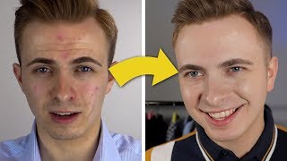 How I Transformed My Face  Best Mens Face Moisturizer [upl. by Nydnarb]