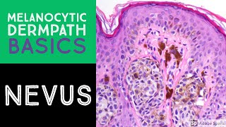 Melanocytic Dermpath Basics Benign Nevus [upl. by Eneluj]