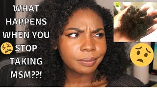 WATCH THIS BEFORE YOU STOP USING MSM FOR HAIR GROWTH  Sharing my experience [upl. by Tnias]