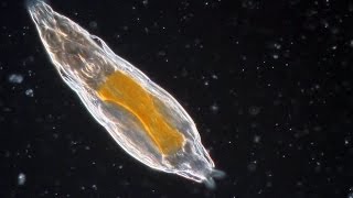 Bdelloid Rotifers so common yet so weird [upl. by Nnaul]