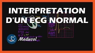 Electrocardiogramme ECG  interpretation dun ECG normal [upl. by Ecirted]