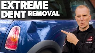 Extreme Dent Removal [upl. by Ahcarb]