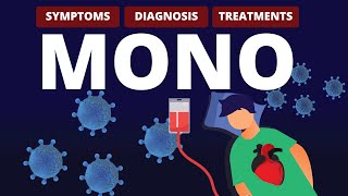 What is MONO Symptoms Diagnosis amp Treatments [upl. by Calida]