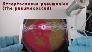 Alpha Hemolysis and Identification of Streptococcus pneumoniae [upl. by Mamie705]