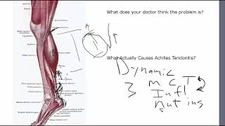 Achilles Tendonitis Is NOT A Tendon Problem [upl. by Nollad]