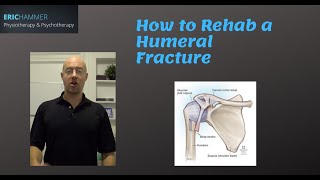 How to Rehab a Humeral Fracture [upl. by Nnylav]